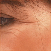 Krähenfüsse Bottrop